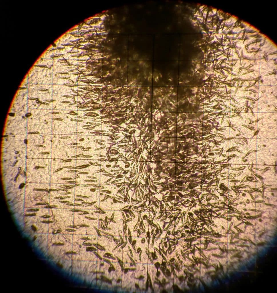 Ascospores under the microscope